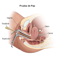 Ilustración de la prueba de Papanicolaou