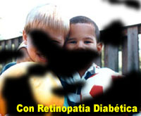 Fotografía simulada de la retinopatía diabética